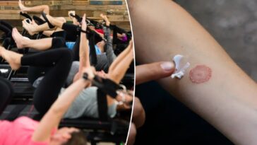 premium-$46-per-class-fitness-studio-is-leaving-gymgoers-with-ringworm:-reports