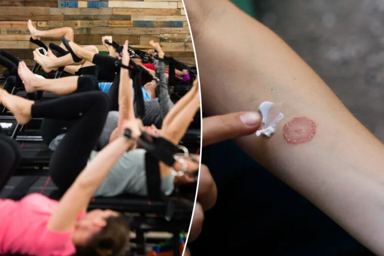 premium-$46-per-class-fitness-studio-is-leaving-gymgoers-with-ringworm:-reports