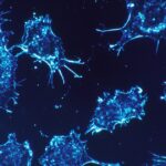 ‘unusual-cluster’-of-rare-child-cancer-cases-triggers-calls-for-investigation