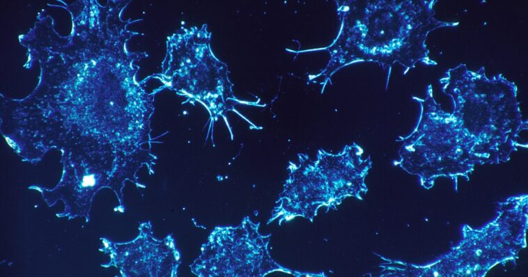‘unusual-cluster’-of-rare-child-cancer-cases-triggers-calls-for-investigation