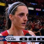 caitlin-clark-records-triple-double-with-10-fractures,-11-concussions,-13-teeth-knocked-out