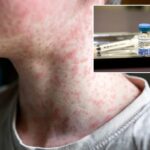 us-hits-most-cases-of-‘world’s-most-contagious-disease’-in-35-years-—-and-it’s-only-july