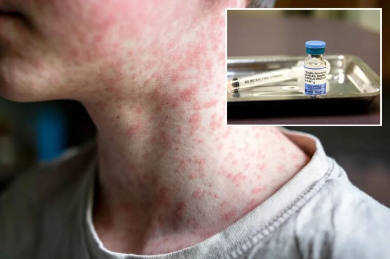 us-hits-most-cases-of-‘world’s-most-contagious-disease’-in-35-years-—-and-it’s-only-july