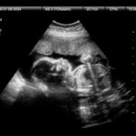 babies-abandoned-in-another-chinese-surrogacy-scandal