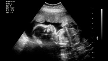 babies-abandoned-in-another-chinese-surrogacy-scandal