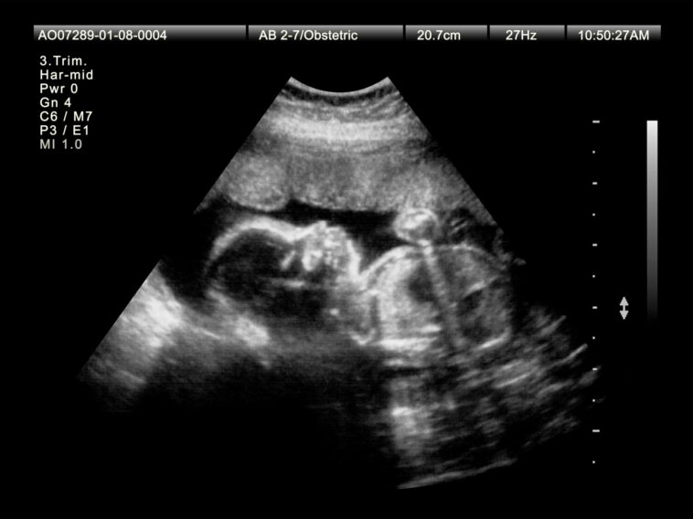 babies-abandoned-in-another-chinese-surrogacy-scandal