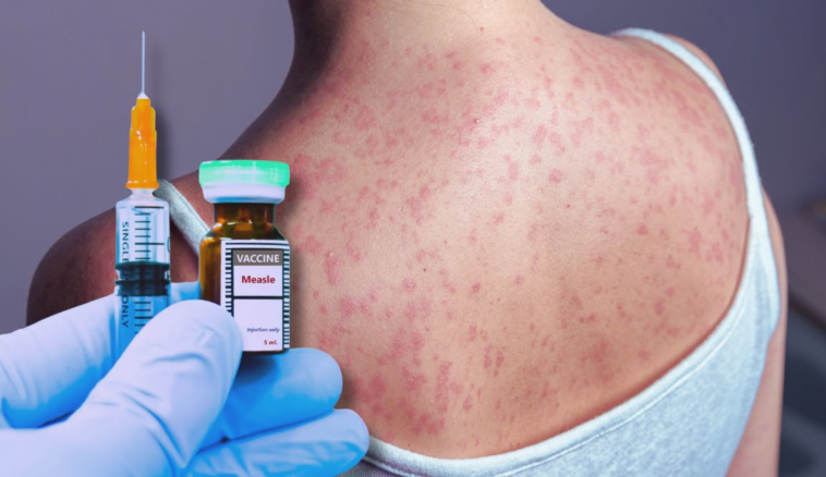 a-disease-once-thought-defeated-is-spreading-across-america