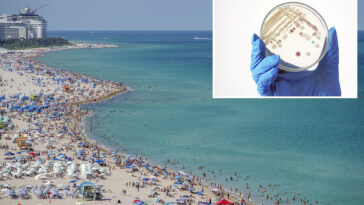florida-patient-dies-from-rare-flesh-eating-bacteria-in-first-fatality-of-the-year
