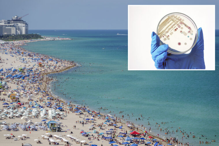 florida-patient-dies-from-rare-flesh-eating-bacteria-in-first-fatality-of-the-year