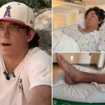 baseball-standout-runs-hospital-dry-of-anti-venom-after-rattlesnake-bite-in-desperate-fight