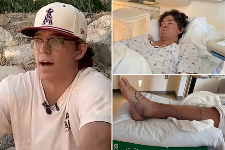 baseball-standout-runs-hospital-dry-of-anti-venom-after-rattlesnake-bite-in-desperate-fight