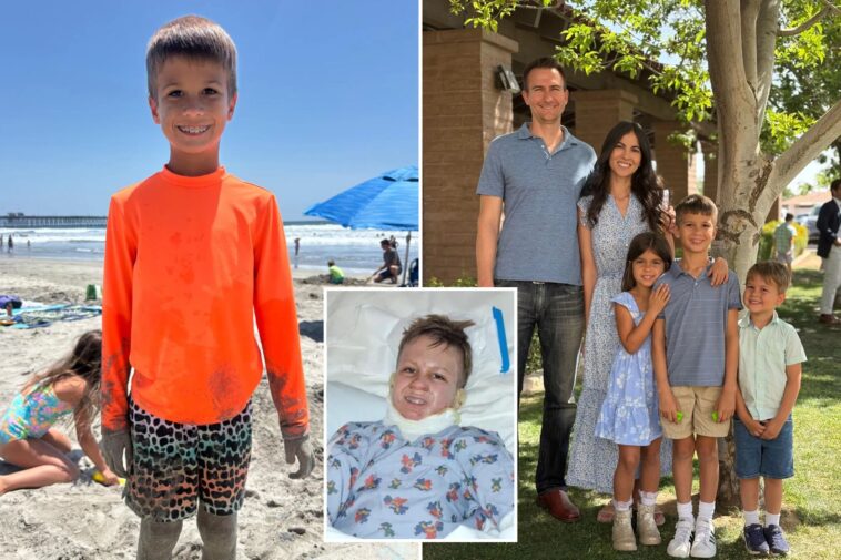 nightmare-california-vacation-for-family-as-fire-pit-shoots-flames-at-8-year-old-boy