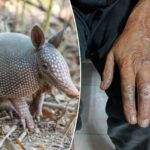 a-biblical-disease-is-back-with-a-vengeance-in-florida-—-experts-warn-which-animal-is-to-blame