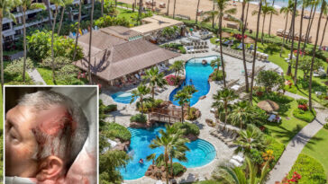 3-teen-boys-arrested-in-bloody-‘anti-white’-attack-on-california-family-at-exclusive-hawaii-resort