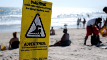 what-us-states-have-seen-flesh-eating-bacteria-cases-this-year?