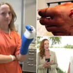 girl,-13,-bitten-by-barracuda-in-bloody-‘horror-movie’-attack-during-turks-and-caicos-birthday-trip