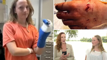 girl,-13,-bitten-by-barracuda-in-bloody-‘horror-movie’-attack-during-turks-and-caicos-birthday-trip