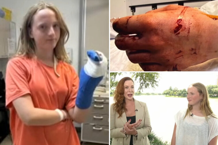 girl,-13,-bitten-by-barracuda-in-bloody-‘horror-movie’-attack-during-turks-and-caicos-birthday-trip