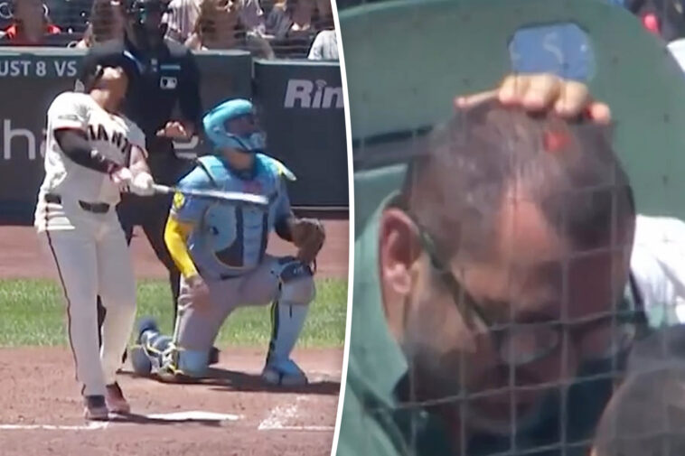 giants-fan-left-bloody-after-taking-foul-ball-off-dome-piece