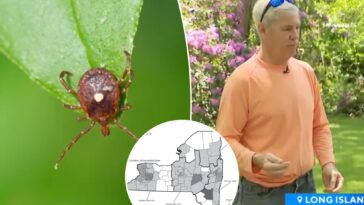 what-is-bourbon-disease?-all-about-the-rare-illness-with-no-cure-diagnosed-on-long-island