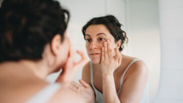 skin-condition-under-the-eyes-goes-viral-as-doctors-warn-it-could-signal-hidden-health-issue