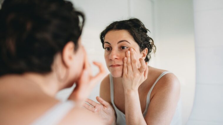 skin-condition-under-the-eyes-goes-viral-as-doctors-warn-it-could-signal-hidden-health-issue