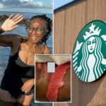 starbucks-horror-as-socal-woman-says-boiling-coffee-spill-led-to-surgery