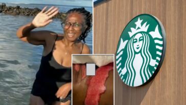 starbucks-horror-as-socal-woman-says-boiling-coffee-spill-led-to-surgery