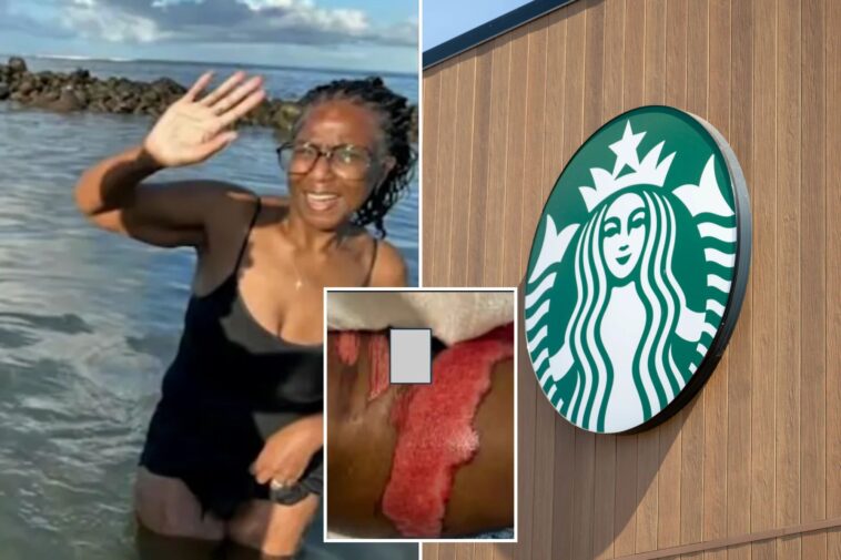starbucks-horror-as-socal-woman-says-boiling-coffee-spill-led-to-surgery