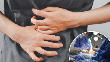 doctor-sews-patient’s-organs-together-—-creating-‘closed-loop’-for-his-poop-in-‘major-surgical-error’