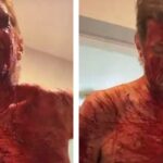 shock:-celebrity-blogger-perez-hilton-self-harms-on-tiktok-livestream-–-fully-nude,-covered-in-blood