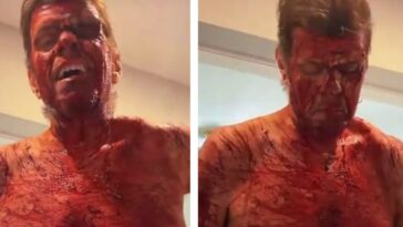 shock:-celebrity-blogger-perez-hilton-self-harms-on-tiktok-livestream-–-fully-nude,-covered-in-blood