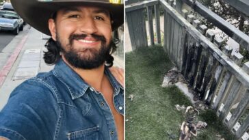 ex-navy-rescue-swimmer-left-with-horrific-burns-after-amazon-fire-pit-erupts-in-his-face