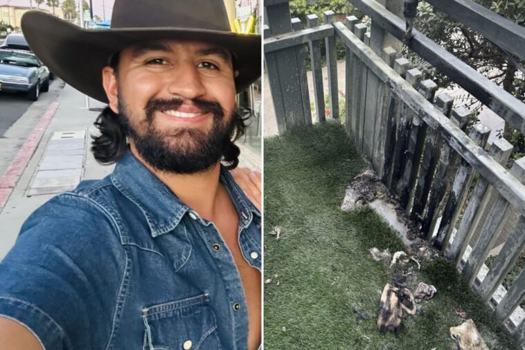 ex-navy-rescue-swimmer-left-with-horrific-burns-after-amazon-fire-pit-erupts-in-his-face