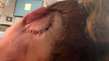 horror:-man-allegedly-beats-doordash-driver-and-mom-of-three-in-shocking-road-rage-incident,-leaving-her-with-horrific-brain-injuries