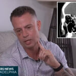 nj-dad-miraculously-survives-after-‘huge’-tree-branch-impales-his-jaw-into-his-brain:-‘mind-boggling’
