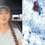 tiktok-food-critic,-29,-details-‘miserable’-experience-of-contracting-‘explosive-diarrhea’-parasite