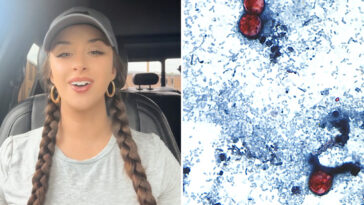 tiktok-food-critic,-29,-details-‘miserable’-experience-of-contracting-‘explosive-diarrhea’-parasite