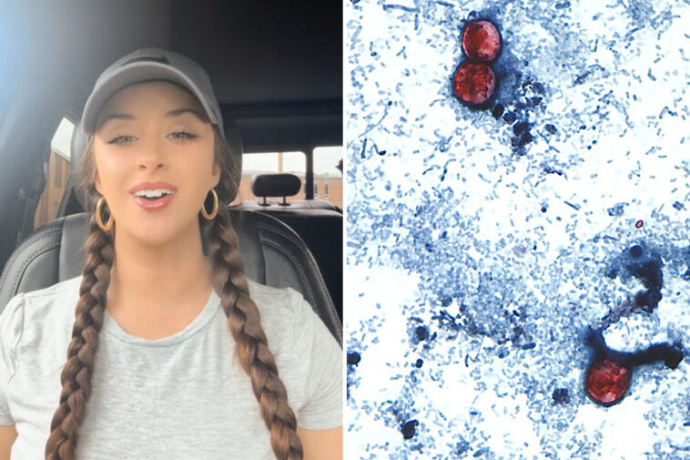 tiktok-food-critic,-29,-details-‘miserable’-experience-of-contracting-‘explosive-diarrhea’-parasite