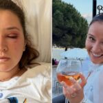 bride-cautions-others-before-wedding-day-about-risky-beauty-treatments:-‘pain-wasn’t-worth-it’