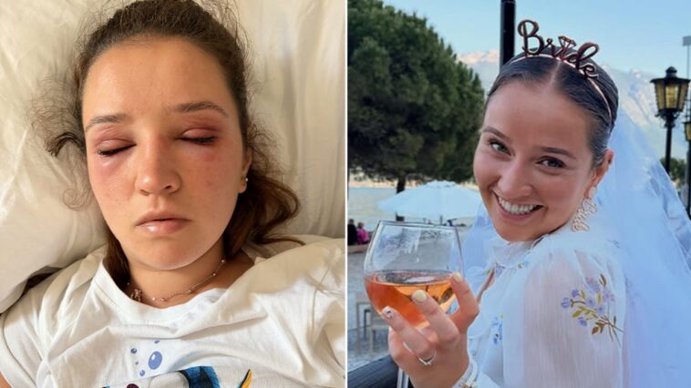 bride-cautions-others-before-wedding-day-about-risky-beauty-treatments:-‘pain-wasn’t-worth-it’