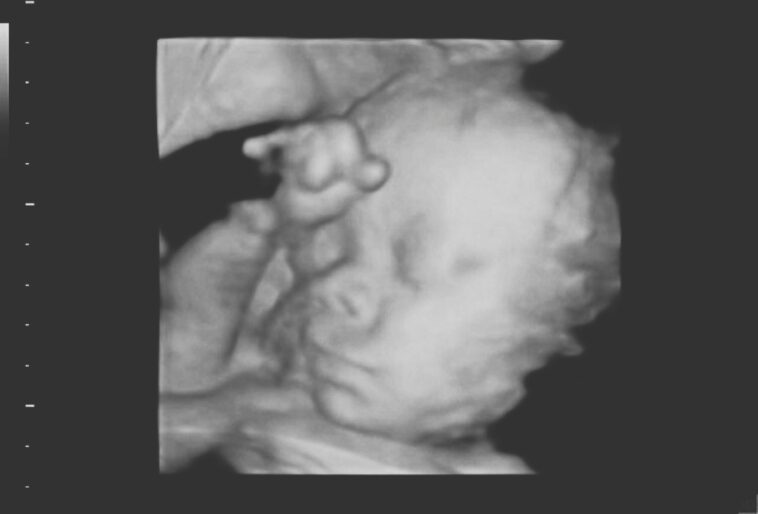 watch:-crowd-laughs-as-dem-governor-allows-abortion-until-birth