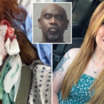 doordash-mom-left-with-skull-fractures,-brain-bleeds-after-man-allegedly-follows-her-and-attacks-with-bat