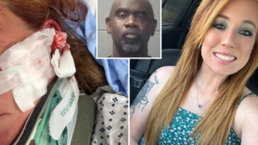 doordash-mom-left-with-skull-fractures,-brain-bleeds-after-man-allegedly-follows-her-and-attacks-with-bat