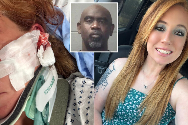 doordash-mom-left-with-skull-fractures,-brain-bleeds-after-man-allegedly-follows-her-and-attacks-with-bat