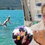 former-olympic-skier-chemmy-alcott-suffers-collapsed-lung-after-front-flip-dive-goes-wrong