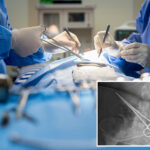here-are-the-states-where-medical-malpractice-runs-rampant-—-and-ny-is-among-the-top