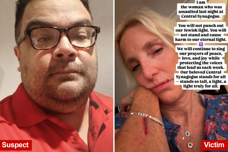 nyc-synagogue-attack-victim-punches-back-at-unhinged-assailant:-‘we-will-continue-to-sing’