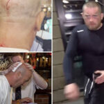 apparently-drunk-man-assaults-israeli-television-crew-in-northern-ireland:-‘f–k-israel’