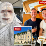 entrepreneur-shows-shocking-photo-after-his-lover-allegedly-attacked-him-in-luxury-french-villa